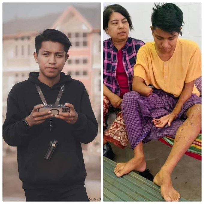 HlyanPhyoAung who needs urgent proper medical treatment hasn’t been included in those released from Magway prison today. We want him released unconditionally. #WhatsHappeningInMyanmar #June30Coup #DreadfulCovidAmidMilitaryCoup