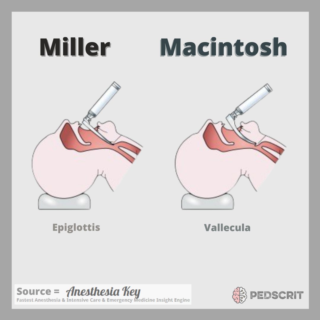 PedsCrit (@critpeds) on Twitter photo We love this graphic of intubating with a Mac vs Miller blade. What's your preference? #PedsICU #MedTwitter #MedEd We love this graphic of intubating with a Mac vs Miller blade. What's your preference? #PedsICU #MedTwitter #MedEd
