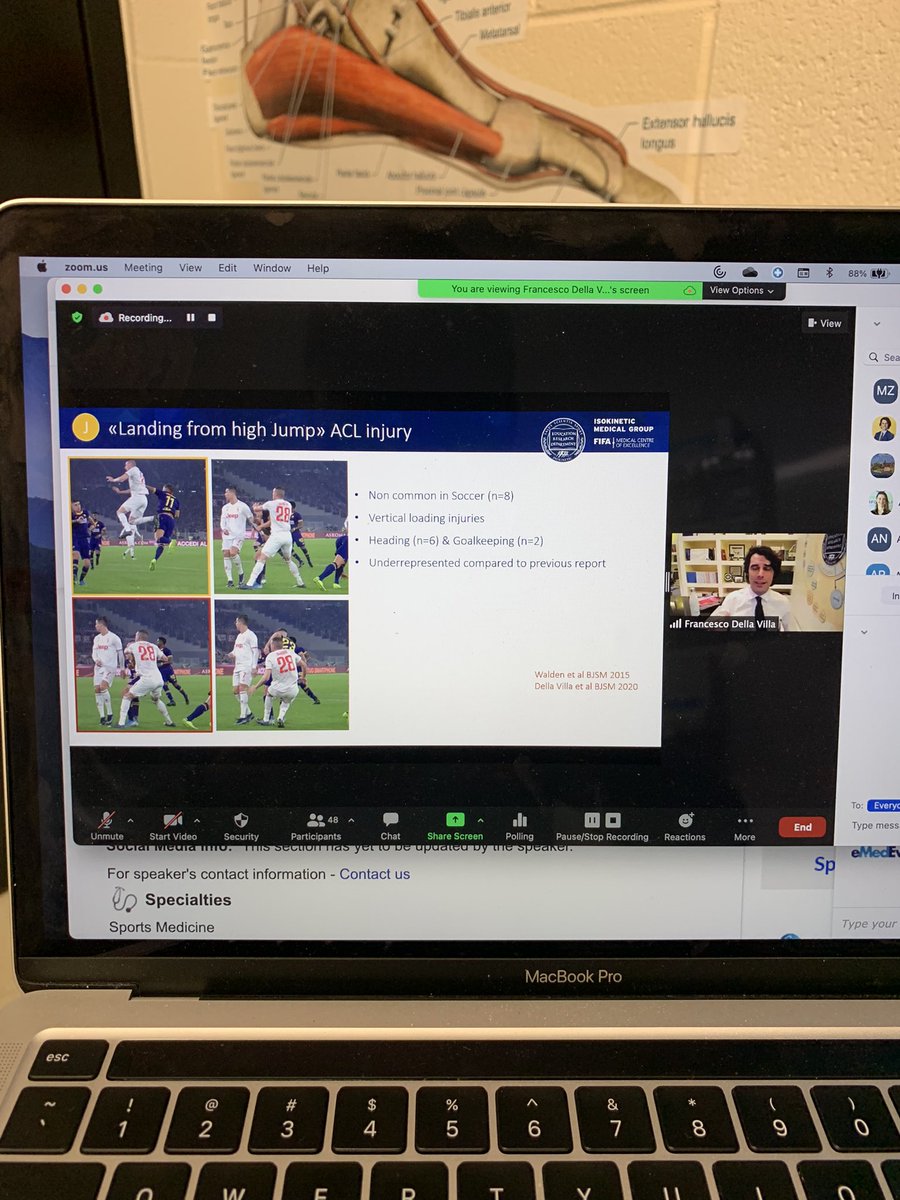 mjzarro's tweet photo. Fantastic chat with @FDellaVilla today for @AASPTCollPro webinar! Great discussion of indirect ACL injury mechanisms and situational context. Thanks for speaking to us! https://t.co/n0TdEeC3DX