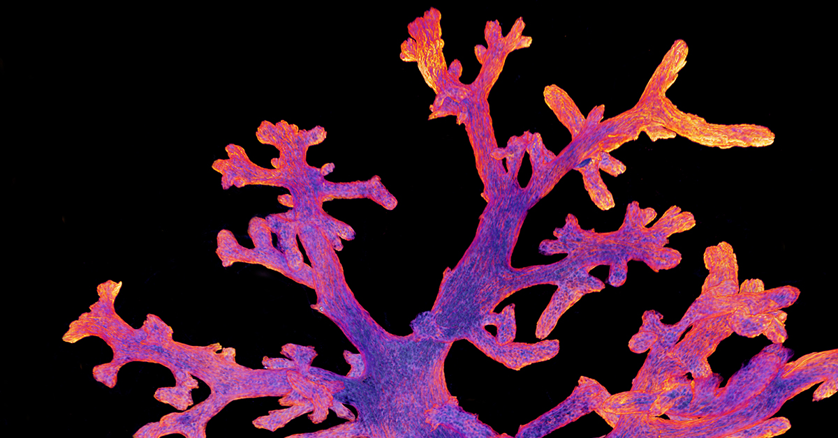 WEHI (Walter and Eliza Hall Institute) (@wehi_research) on Twitter photo A new paper from WEHI’s breast cancer and bioinformatics researchers has used single-cell transcriptomics to create an extensive ‘atlas’ of how mammary epithelial cells develop.
Read the paper in <a href="/BCRJournal/">BreastCancerResearch</a>: …ast-cancer-research.biomedcentral.com/articles/10.11… A new paper from WEHI’s breast cancer and bioinformatics researchers has used single-cell transcriptomics to create an extensive ‘atlas’ of how mammary epithelial cells develop.
Read the paper in <a href="/BCRJournal/">BreastCancerResearch</a>: …ast-cancer-research.biomedcentral.com/articles/10.11…
