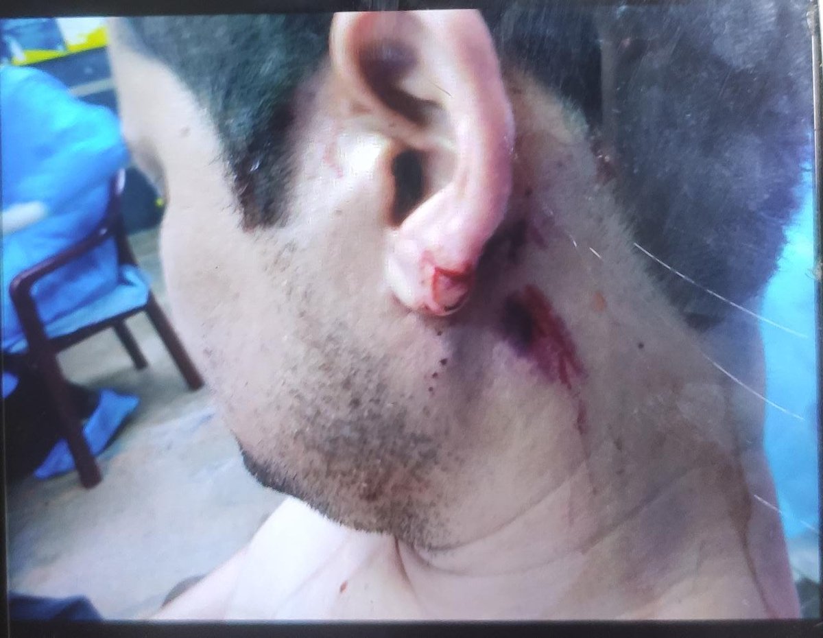 RDAAIIMS DELHI tweet media