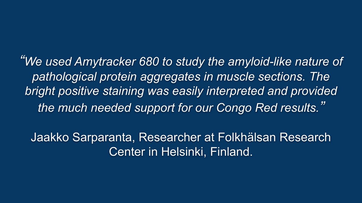 Customer satisfaction is our main priority. So when we receive feedback like the one from @JSarparanta at @FolkhalsanRC in Helsinki, Finland, we want to spread the word to other researchers in the field. 

Click here for more testimonials:
https://t.co/JlGtpPfKfI https://t.co/80Bs9hfKPU