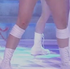 hyeju's knees is bleeding ;((