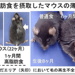 原因が判明!？薄毛の原因は脂っこい食事にあった!