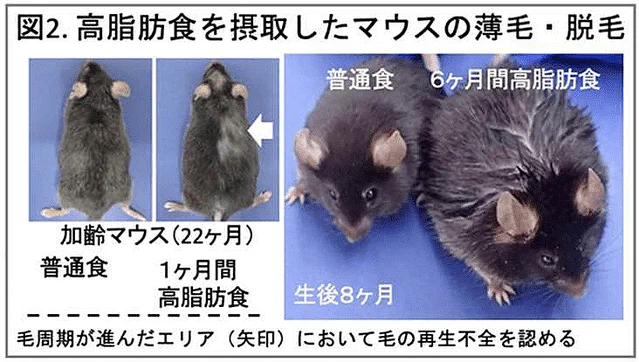原因が判明！？薄毛の原因は脂っこい食事にあった！