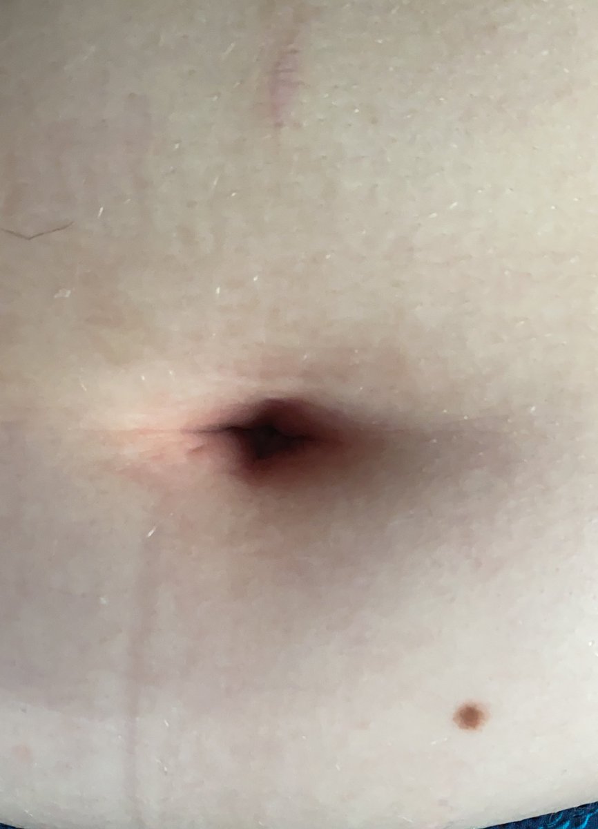 QuestionsThings's tweet photo. I wish I had someone to torture my navel https://t.co/SKJ3JifWmh