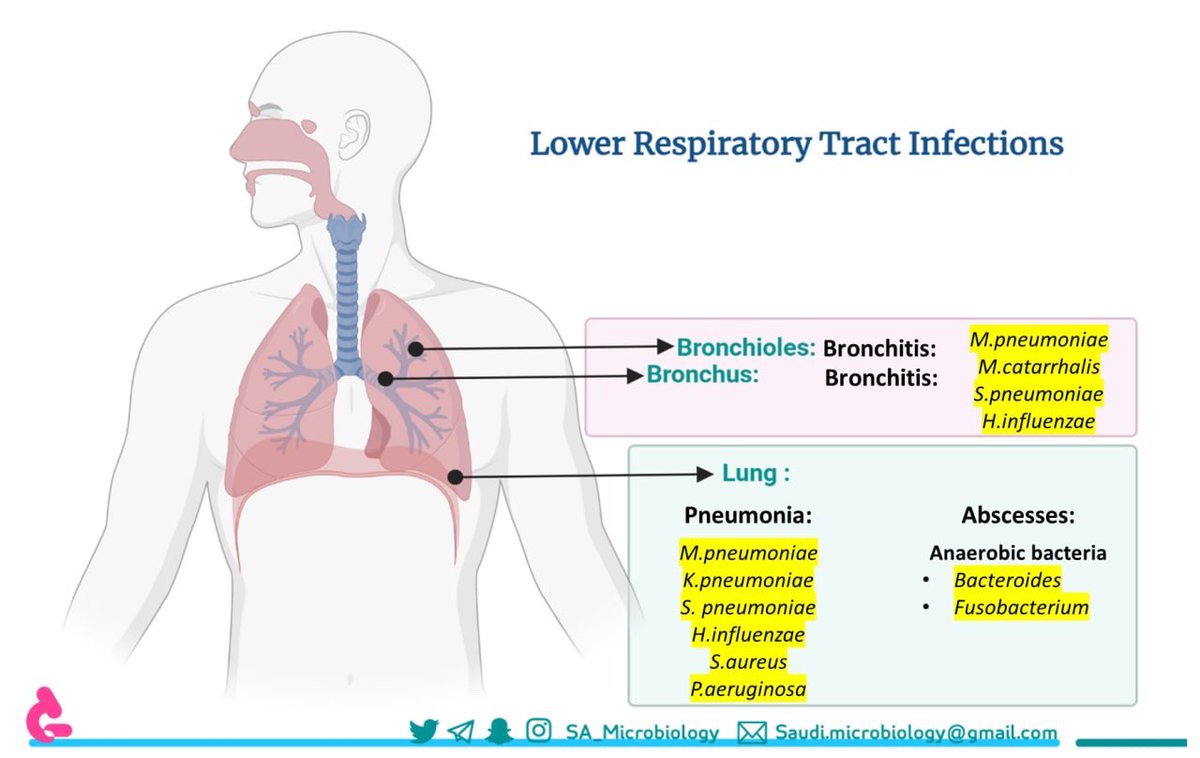 في هذا الثريد سوف نتحدث عن عدوى الجهاز التنفسي السفلي

فضل التغريدة اذا كنت مشغول https://t.co/gldIy...