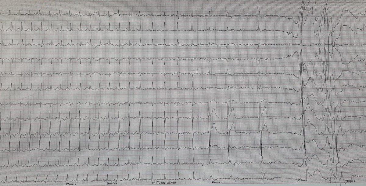 Anunay Gupta MD, DM tweet media