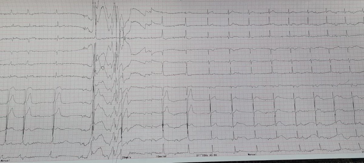 Anunay Gupta MD, DM tweet media