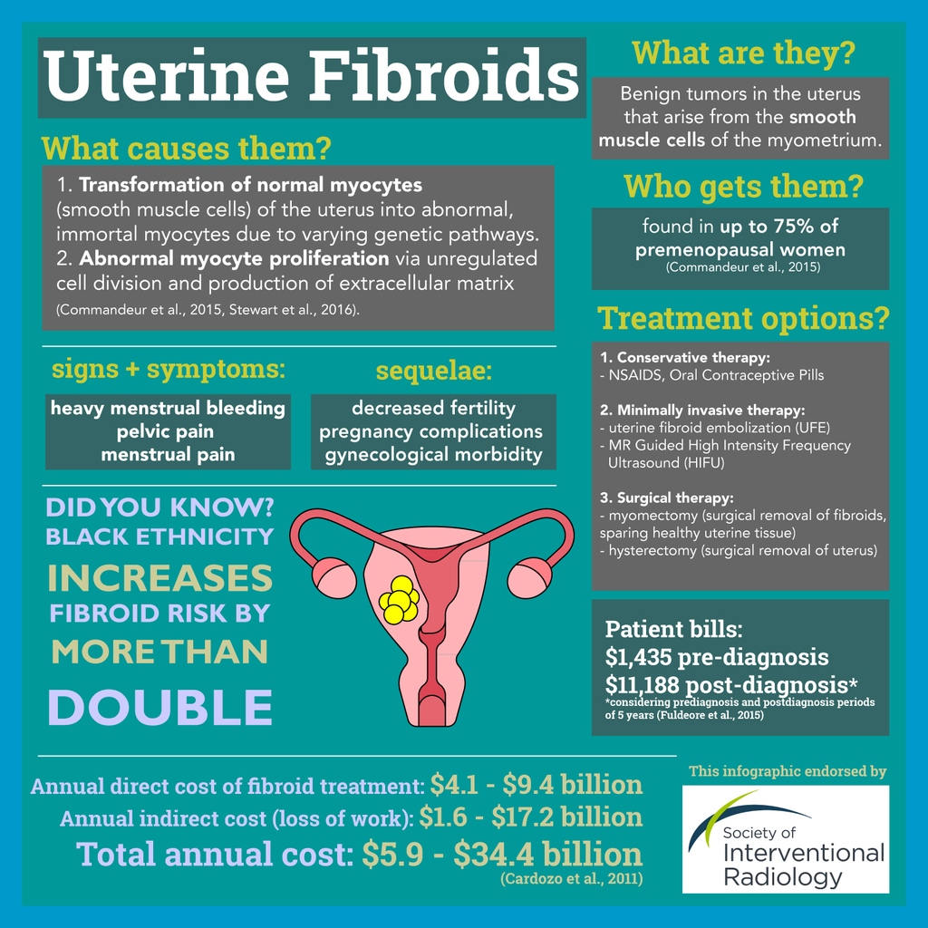#July is #FibroidAwarenessMonth! Here is an infographic on #UterineFibroids created by the SIR MSC D&amp;I Committee. 

#FibroidAwareness #TwittIR #IR #SIR #IRad #UFE #MedTwitter #MedStudentTwitter