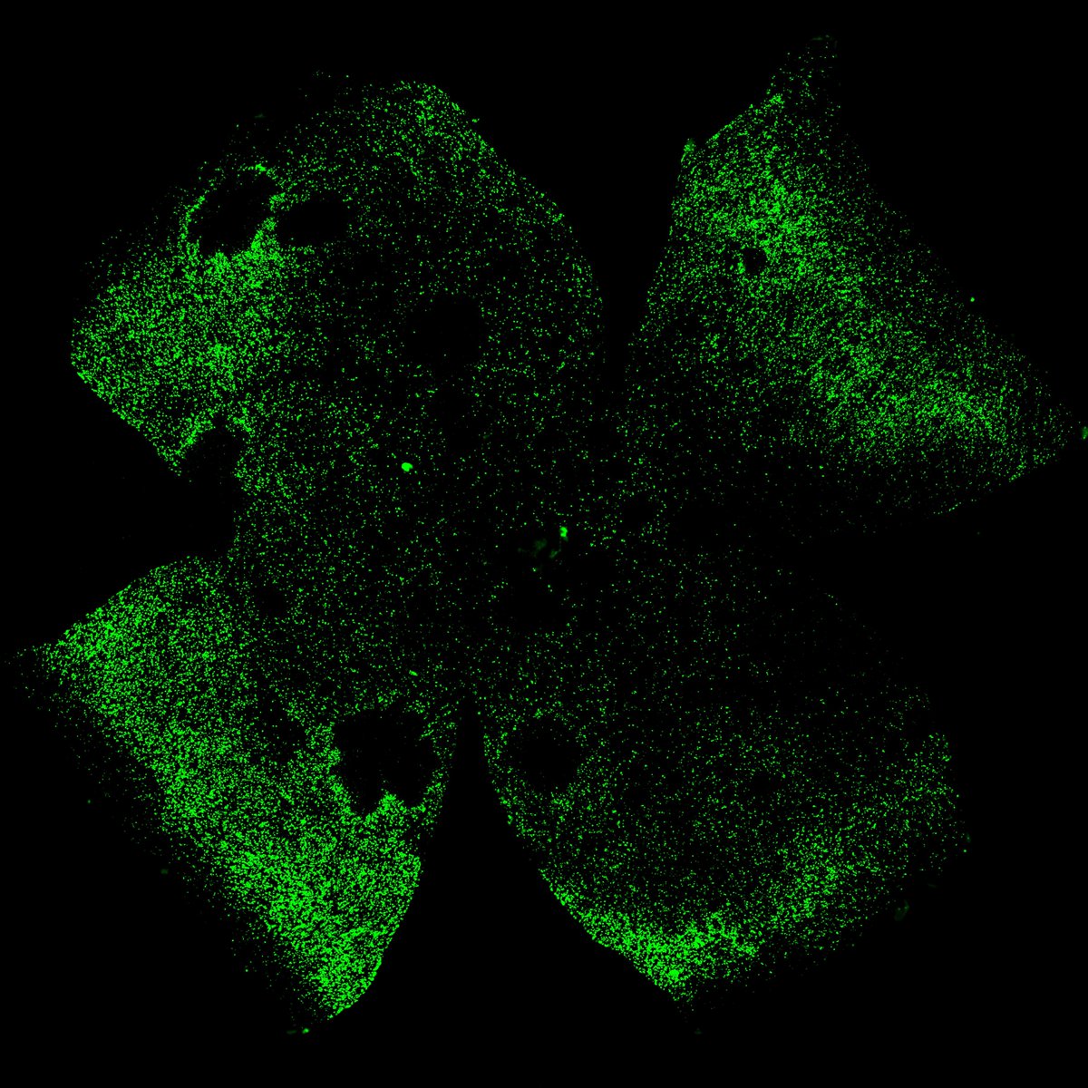 Sean Ku Wang (@seankuwang) on Twitter photo CD47 is best known as a cancer target, but can the "don't eat me signal" also help protect cells?
Our latest paper in <a href="/JCI_insight/">JCI insight</a> suggests yes! Using CD47, we design an AAV gene therapy that slows retinal degeneration in mice. w/ <a href="/YunluSawyerXue/">Yunlu Sawyer Xue</a>
insight.jci.org/articles/view/… CD47 is best known as a cancer target, but can the "don't eat me signal" also help protect cells?
Our latest paper in <a href="/JCI_insight/">JCI insight</a> suggests yes! Using CD47, we design an AAV gene therapy that slows retinal degeneration in mice. w/ <a href="/YunluSawyerXue/">Yunlu Sawyer Xue</a>
insight.jci.org/articles/view/…