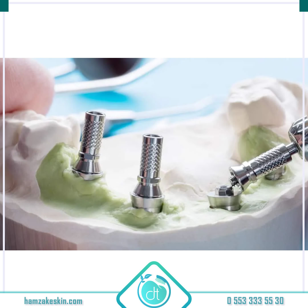 💧 İmplance implant markası dünya genelinde bilinen bir markadır. 
💧 İmplance İmplant Tedavisi 👉 bit.ly/3gvBwxH

#keskindişklinik #ağızestetik #dişbeyazlatma #zirkonyum #nucleoss #kaplama #beyazlatmafiyatları #implance #implantmarkası