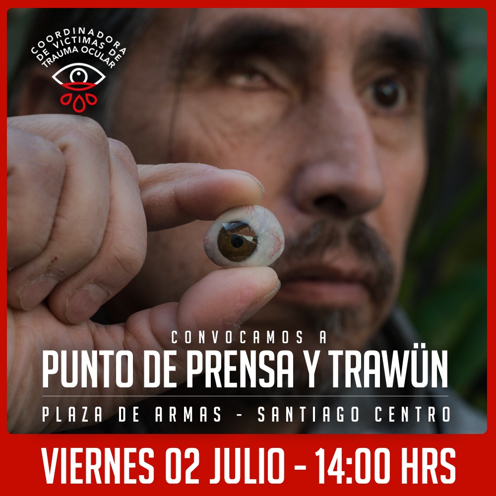 traumaocular's tweet photo. 🔴PUNTO DE PRENSA
Mañana 2 de julio, daremos punto de prensa a las 14.00 hrs en Plaza de armas.
Esto, para denunciar nuevamente las falencias del PIRO del Hosp Salvador y del ausentismo del INDH con respecto a la violación de DDHH.
Invitamos a todos los medio de prensa a asistir. https://t.co/IbkoiJ49IZ