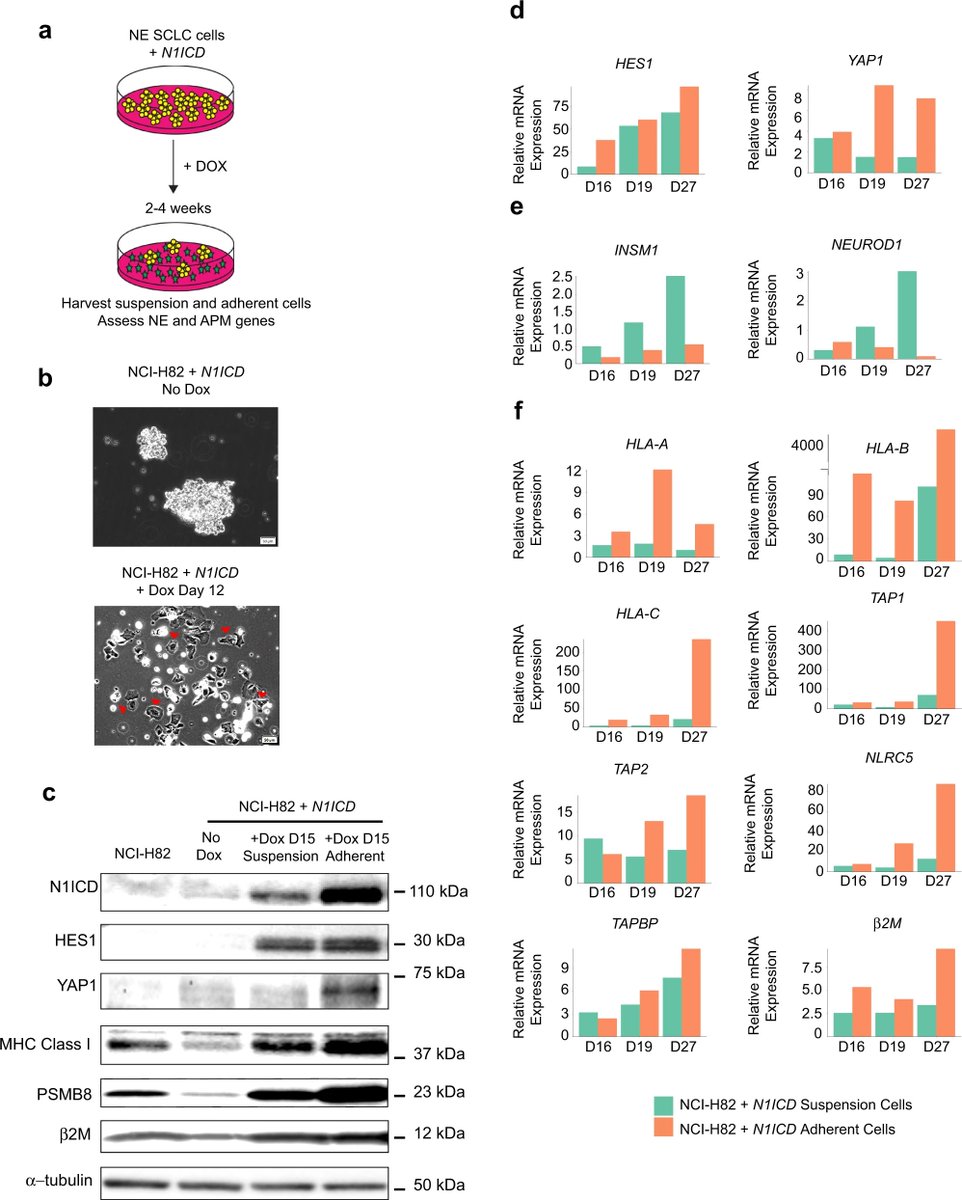 Dr_Ivanoncologo's tweet photo. #Immune checkpoint blockade benefits only a small subset of #patients with SCLC💡🤔
The #authros of this #study performed immunogenomic profiling of #tumor samples and found that elevated Notch signaling predicts #clinical benefit to Immune checkpoint blockade‼️ https://t.co/gDce3YE0HE