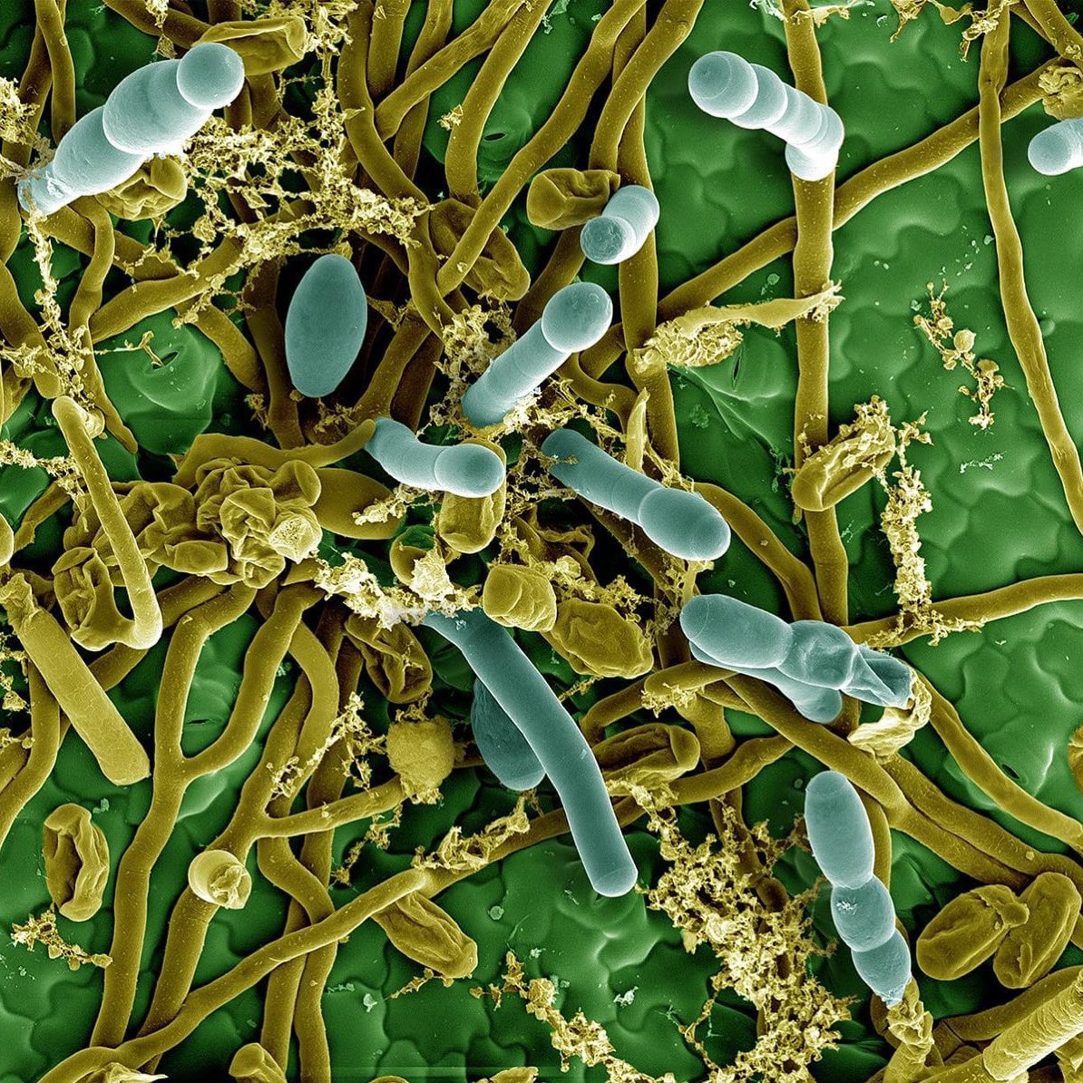 June Image Contest Winner is "Fungal Invasion"! Congratulations to Peta Clode for collecting this image &amp; Jeremy Shaw for colorizing it in Photoshop. This was done on the JEOL IT800 FESEM fitted with a Leica VCT500 cryosystem. The sample is mildew on a zucchini leaf!