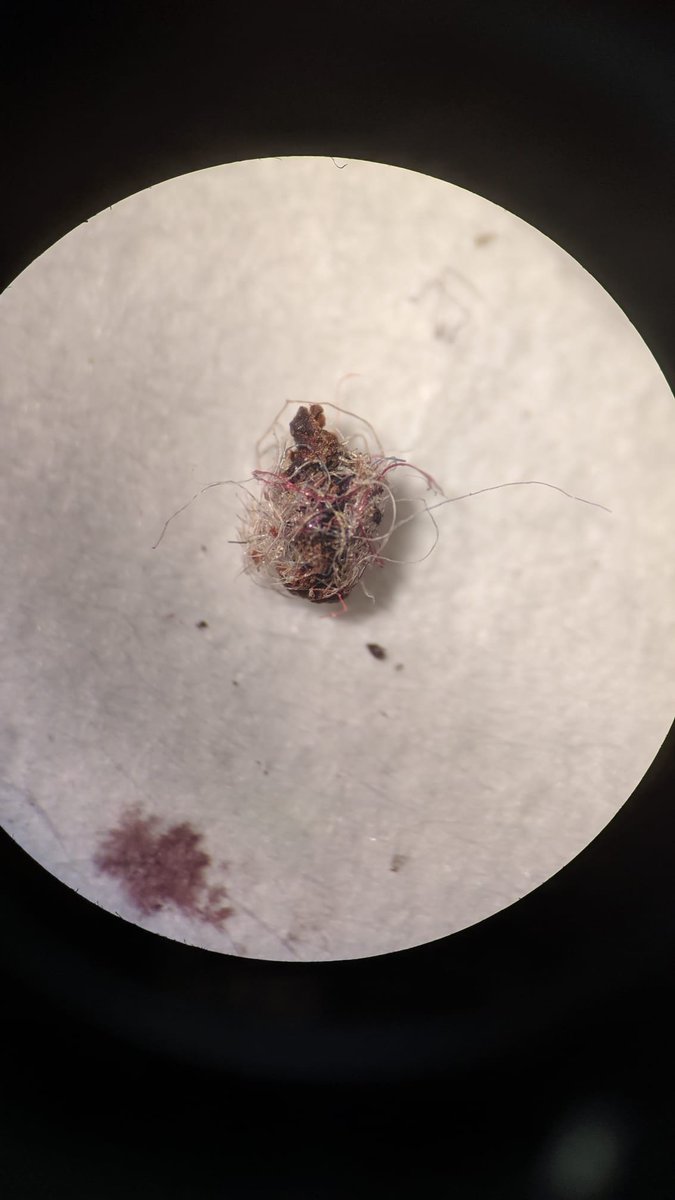 phenogirl's tweet photo. It is confirmed, we are accidentally finding plastic fibers in fecal samples of passerine birds that are mostly frugivores. This is scary and opens to me an unexpected new field of research that I would like to expand in the future. #plasticfree #seed_dispersal #TEMPNET @ebdonana https://t.co/FfkmCm3jli
