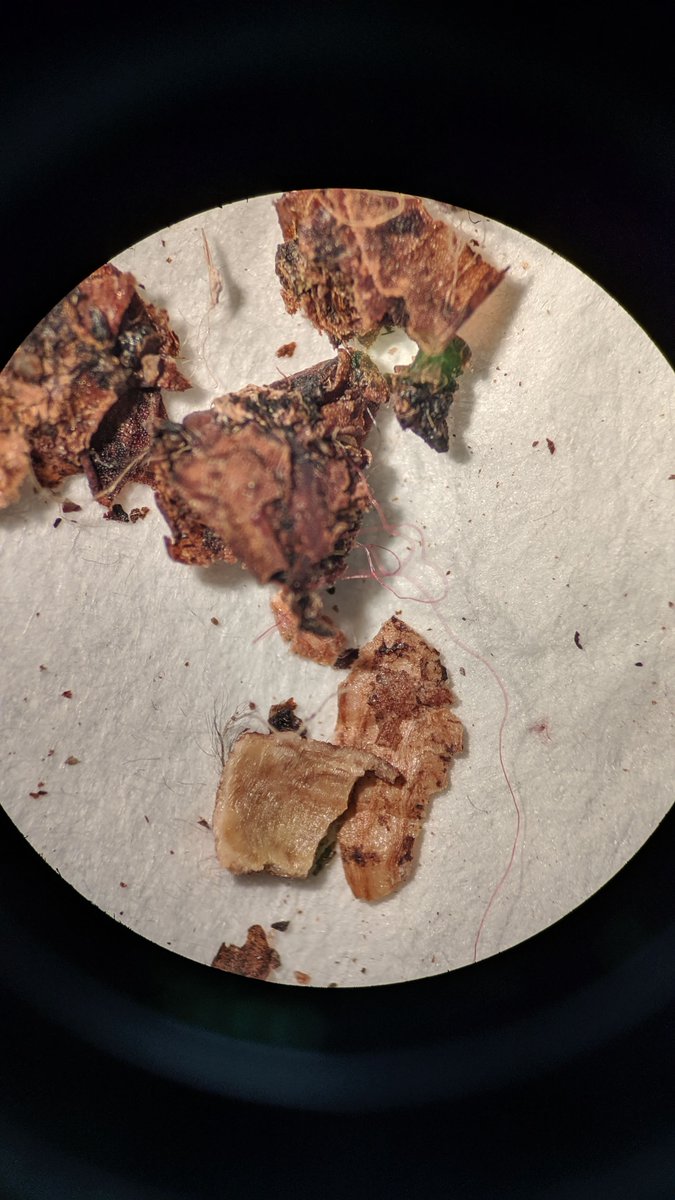 phenogirl's tweet photo. It is confirmed, we are accidentally finding plastic fibers in fecal samples of passerine birds that are mostly frugivores. This is scary and opens to me an unexpected new field of research that I would like to expand in the future. #plasticfree #seed_dispersal #TEMPNET @ebdonana https://t.co/FfkmCm3jli