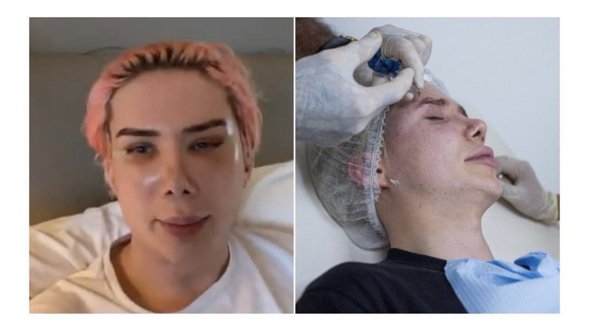 Javierito321's tweet photo. Influencer Británico que no se siente hombre ni mujer y se hace llamar “no binario”, ahora se identifica como Coreano y se sometió a 18 cirugías para parecerse a los del grupo “BTS”

¿Les parece esto orgullo o trastorno?

¿Tener empatía es aplaudirlo o reconocer el problema? https://t.co/Bx2nhKv4E4