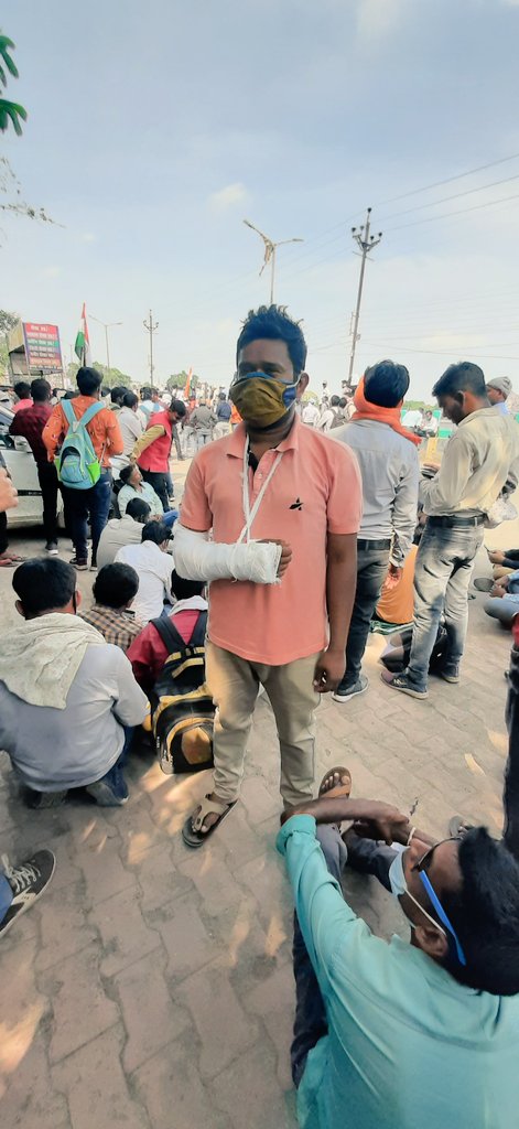 Pushkar97230071's tweet photo. चोटिल होने के बाद भी शिक्षक भर्ती आंदोलन में अपना पूरा सहयोग देता हुआ चयनित शिक्षक भाई..सर के जज़्बे को सलाम है I इतनी कड़ी मेहनत के बाद भी हमे नियुक्ति नहीं मिल रहीं है यह छत्तीसगढ़ सरकार की अनदेखी हम चयनित शिक्षकों को बेरोजगारी का दंश झेलने को मजबूर कर है I https://t.co/10RnRgjdxA
