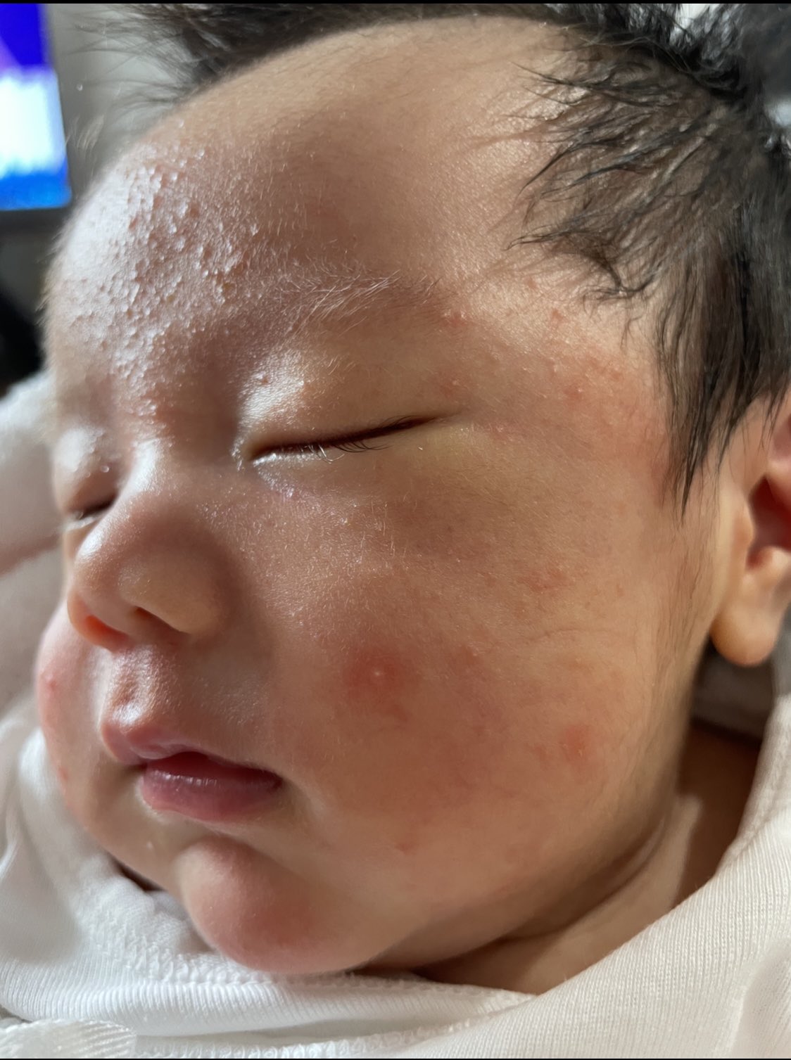 澪ちゃんママ 1m 37w Twitter पर 生後1ヶ月頃から乳児湿疹出てきて顔中真っ赤にブツブツだったけど Nico石鹸使ったら2日で 湿疹が引いてきた 明らかに良くなってるから まじスゲー これゎ続けるべし T Co Kx5t9yql4l Twitter