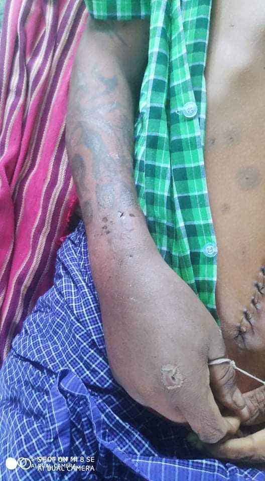 -TW // Death
On June 29, at around 11 pm, Pho Khaung Ward, #Pyay Township, Junta terrorists falsely accused and abducted Ko Soe Min for destroying Mya Ywa School. On July 1, they ordered his family to retrieve his body, which was full of tortured wounds.
#WhatsHappeningInMyanmar