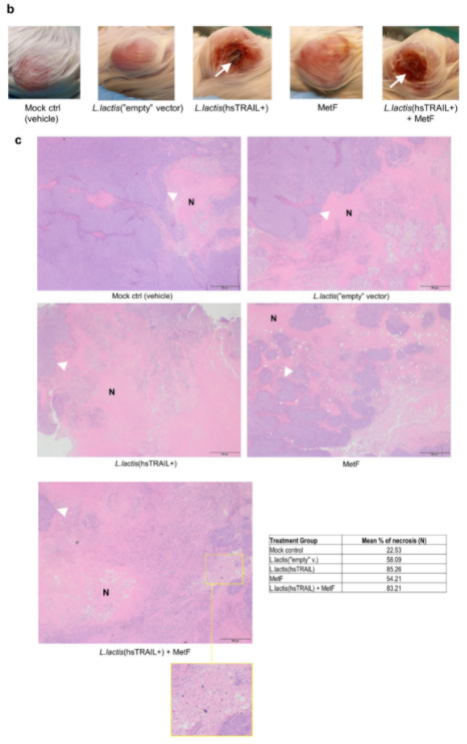 CancerNemi's tweet photo. The Anti-Tumor Effect of Lactococcus lactis Bacteria-Secreting Human Soluble TRAIL Can Be Enhanced by Metformin Both In Vitro and In Vivo in a Mouse Model of Human Colorectal Cancer
Katarzyna Kaczmarek et al 
|Cancers|

https://t.co/0Zm5FygQZS

#H2020 #MSCA #cancerproject https://t.co/u1ImX57RLv