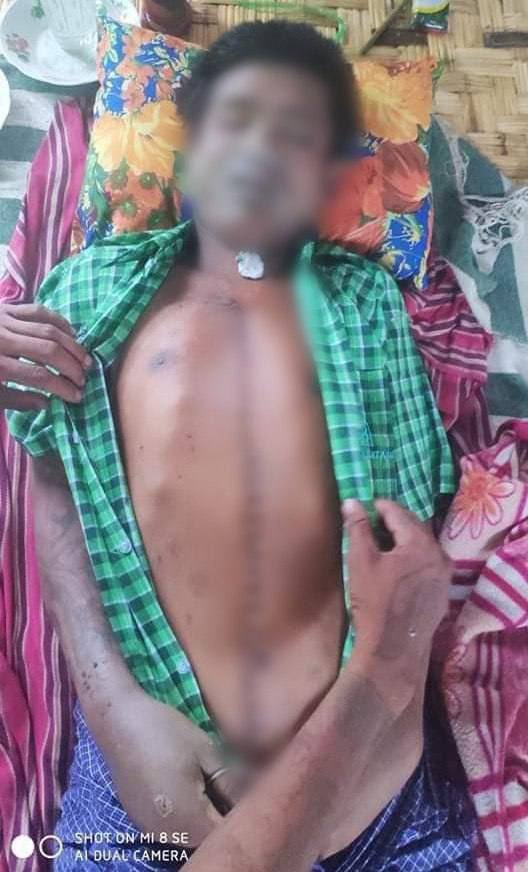 William98978's tweet photo. tw // death SAC terrorists accused Ko Soe Min for destroying Mya Ywa school and arbitrarily abducted him on June 29. Family got informed to retrieve his dead body on July 1 with full of tortured wounds. #July2Coup #WhatsHappeningInMyanmar https://t.co/qcmgFzzJMk