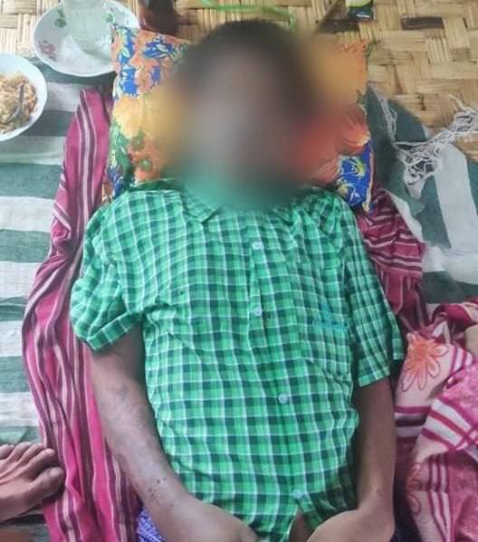 tw // death SAC terrorists accused Ko Soe Min for destroying Mya Ywa school and arbitrarily abducted him on June 29. Family got informed to retrieve his dead body on July 1 with full of tortured wounds. #July2Coup #WhatsHappeningInMyanmar