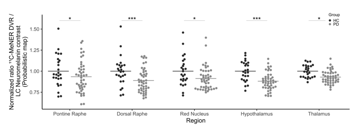 cejdoppler's tweet photo. However, the individual ratios of noradrenaline transporter density and LC MRI contrast were lower in PD patients, suggesting a pronounced noradrenergic terminal loss relative to cellular LC degeneration in Parkinson’s disease. 🧠 https://t.co/vWfxSq5cHu