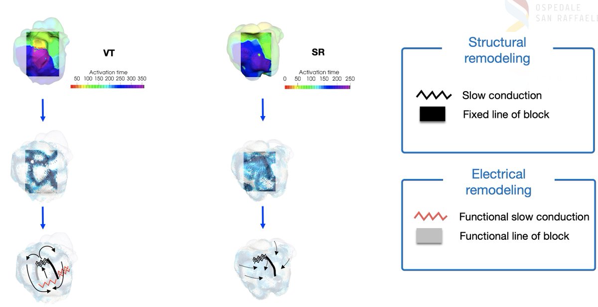 sozi81's tweet image. #StructuralRemodeling vs #FunctionalRemodeling. Here a representation of this phenomenon in the V setting. What about Atria? Can we predict from sinus rhythm what happens during AF? Tomorrow #RISM math talk 2.40PM. iheart.polimi.it/mcf2021/