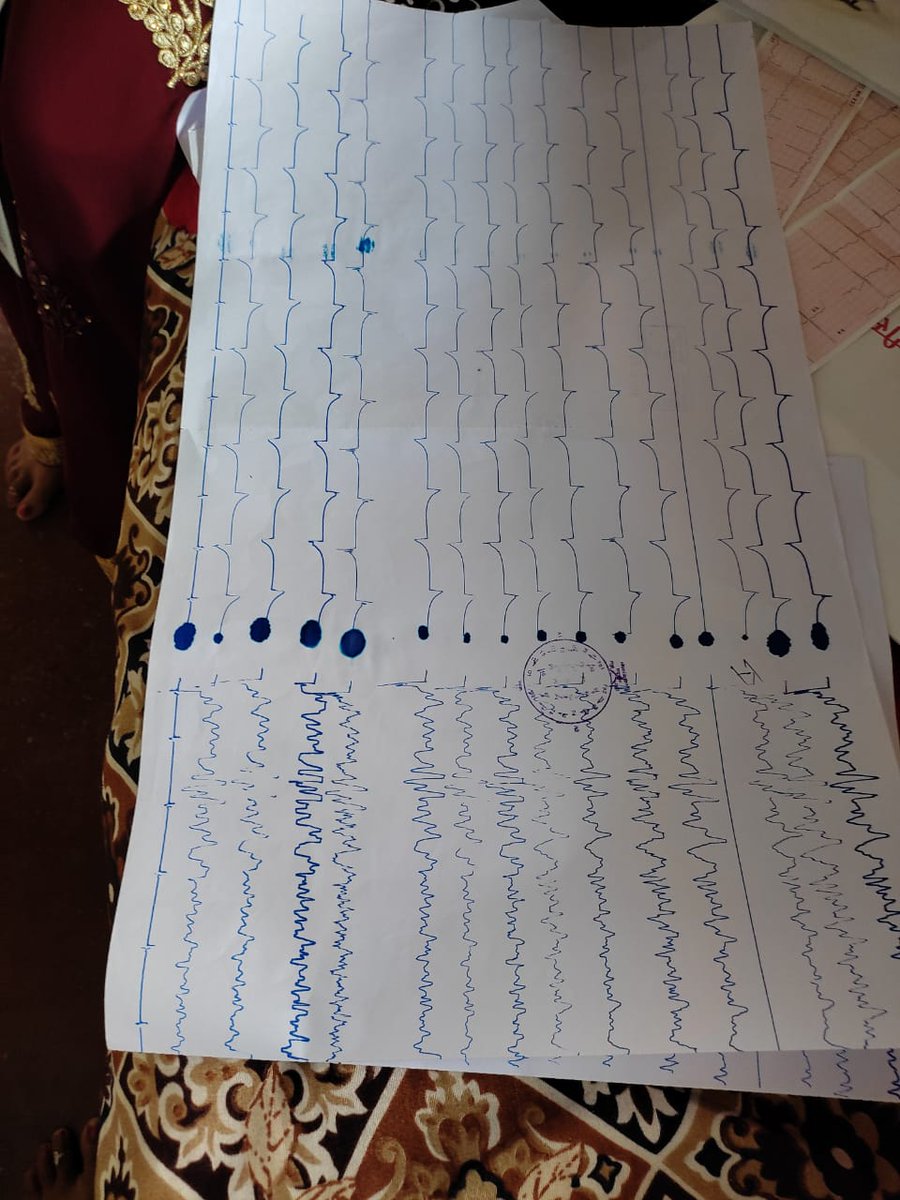 Abhishek_and140's tweet photo. she hd brain hemorrhage on 25 June &amp; half of body is paralysed. Her family is farmer in Tema, Madhepura (Bihar) leased agri land nd spent lakhs on trt &amp; ran out of money so returned home in critical cond. She need bttr trt/brain surgery. Plz help sir @SonuSood @SoodFoundation https://t.co/Nn90SRlYBj