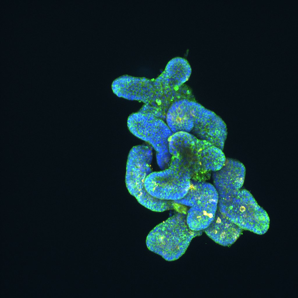 With this weeks achievement of beautiful 3D images of my intestinal #organoids, I feel ready to finally head off on some relaxing vacation.
See you back in 2 weeks little organoids aka science partner in crime! <a href="/DKFZ/">DKFZ</a> <a href="/Boutroslab/">Boutroslab</a>