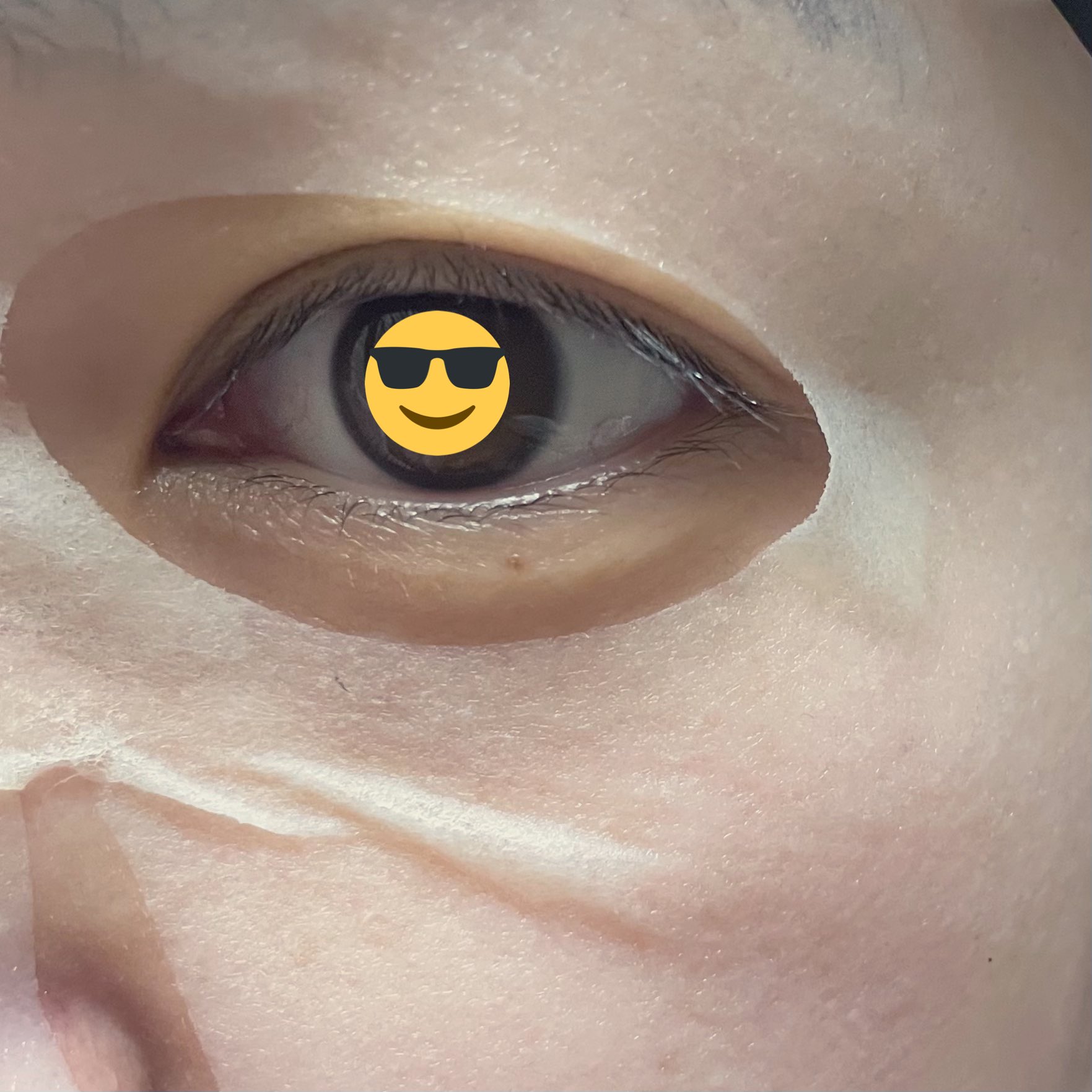 透明白肌 Twitter Search Twitter