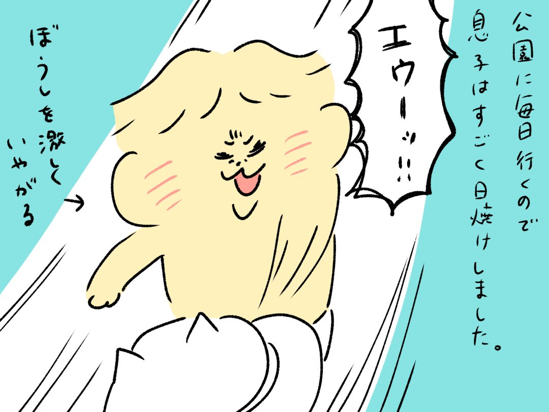 息子の日焼けについて 