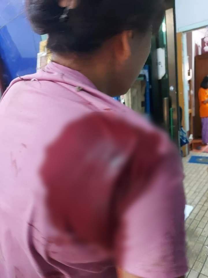 Tw // wound
Junta opened Heavy Weapons (RPG) in the wards of #KawLin city and hit on the roof and at least 2women were injured Reportedly.After the broke out with Regional PDF and SAC ,they opened indiscriminately in this afternoon and also stationed at tsp Administrative Office.