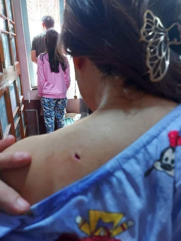 nslwin's tweet photo. KAWLIN, Sagaing Region:

A fight broke out between People's Defence Force and SAC Terrorists today afternoon. SAC Terrorists fired RPG and some houses were destroyed. 

Two WOMEN INJURED by the bullets fired by SAC Terrorists.

#July2Coup #WhatsHappeningInMyanmar #MilkTeaAlliance https://t.co/exUKkvG5Aj