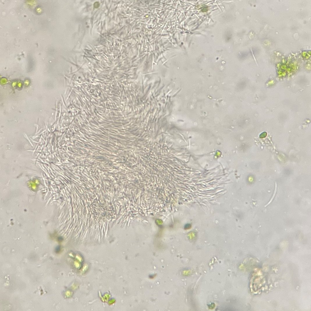 MartinChilvers1's tweet image. Tar spot confirmed @checkjill Eaton co, MI July1, 8% incidence all single lesions on lowest leaves in dry land field. Extended leaf wetness has primed the pump. Note lesion protruding through the bottom side of the leaf @MI_Corn @MSUAgBio @NationalCorn 
cropprotectionnetwork.org/series/tar-spo…