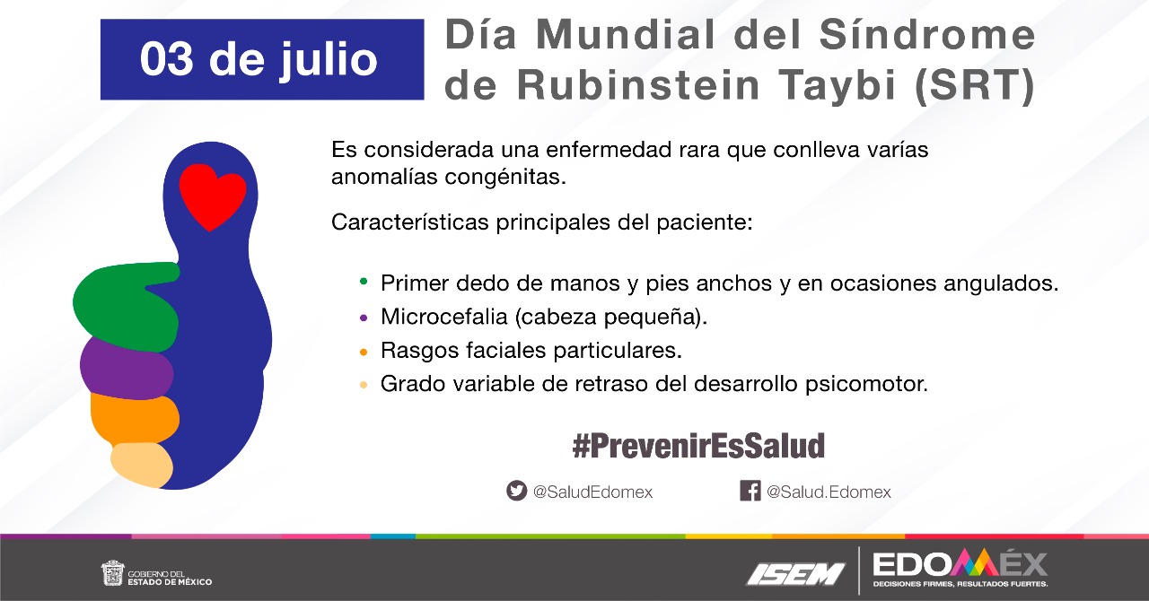 Día Mundial del Síndrome de Rubinstein Taybi