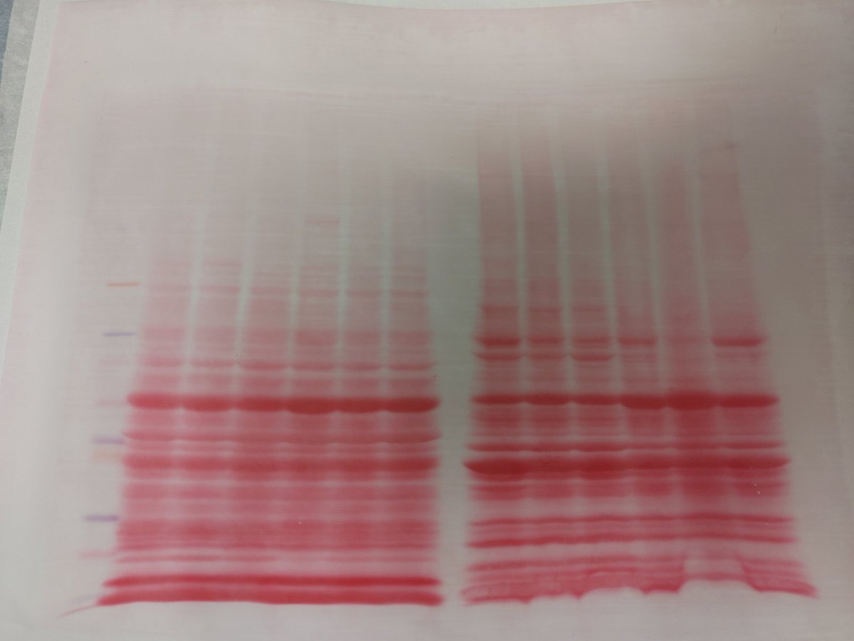 MicheleLabUM's tweet photo. Followed by fist bumps and a nice set of blots waiting for us after the holiday. Great job Ella #FirstWestern https://t.co/XVb0816AEr