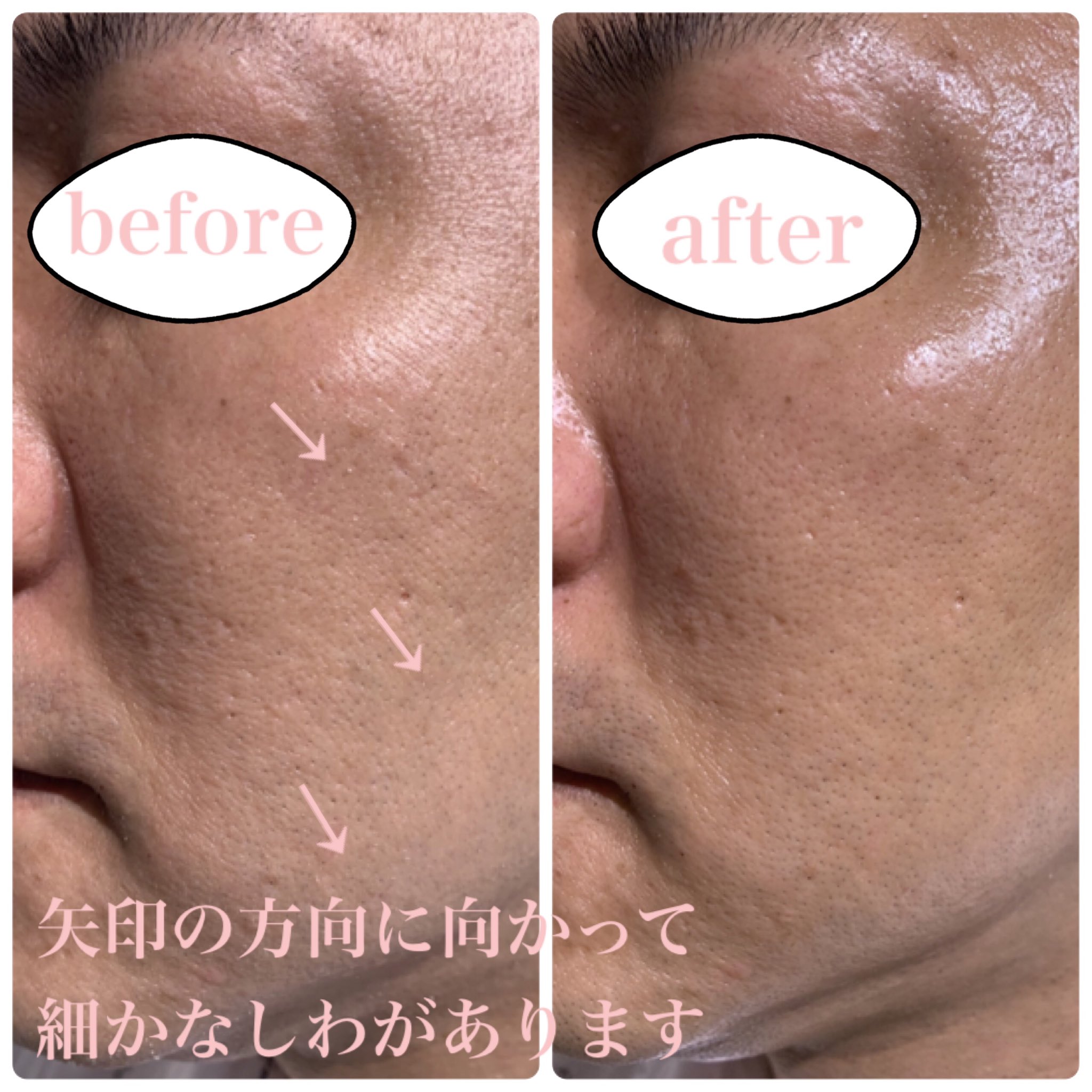 売れ筋介護用品も！ 碧 ハーブピーリング 碧ハーブピーリングについて