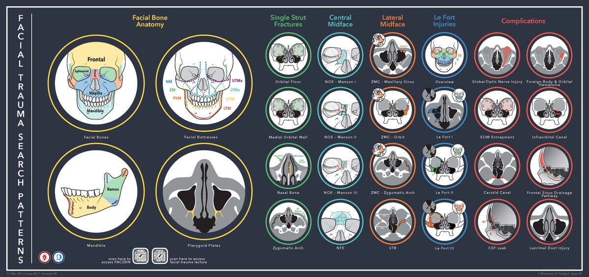 Holiday weekend that involves 🧨means a busy  weekend for facial trauma.  

Facial trauma can be pretty overwhelming.  Need a tutorial for how to approach patterns of injury &amp; complications? This graphic has what you need. 

For more, check out learningheadandneck.com 
#foamrad