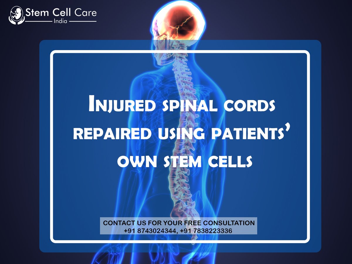 StemCellCare's tweet photo. Injured #SpinalCords Repaired Using Patients Own Stem Cells
To know more about Spinal Cord Treatment, visit https://t.co/UAO0Yl8dbF
#spinalcordinjury #spinal #spinesurgery #stemcellrepair https://t.co/VrSow0TvTn