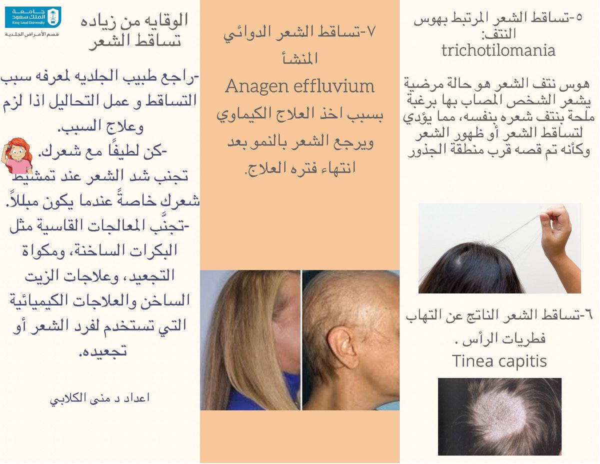 DERMA_KSU's tweet photo. هناك أسباب متعددة لتساقط الشعر بداية من التغييرات في النظام الغذائي وصولا إلى الأمراض المزمنة، وفي هذا التقرير الشامل نعرفكم على أبرزها، وعن طرق الوقاية من زياده تساقط الشعر..#الامراض_الجلديه #تساقط_الشعر #الثعلبة #تساقط_الشعر_الكربي #مشاكل_الشعر #hair_fall #Alopecia https://t.co/G2iJ4N4JM0