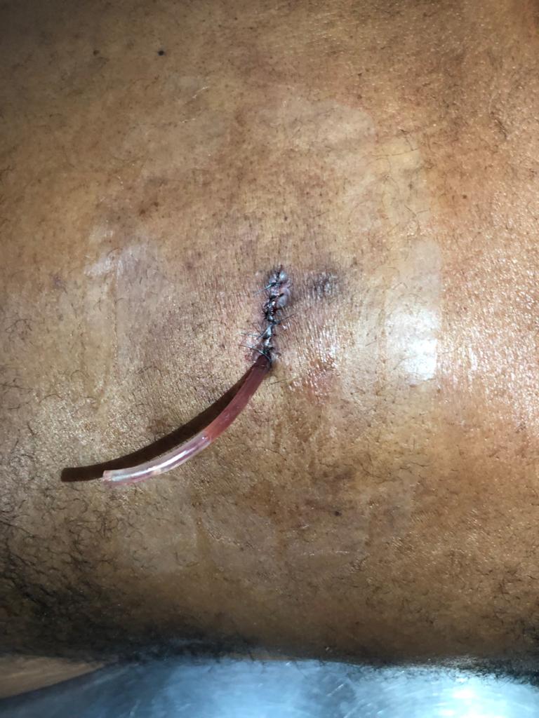 Alberto34000396's tweet photo. UD 337 Realizando Cirugía Menor https://t.co/VEJDFFijGH