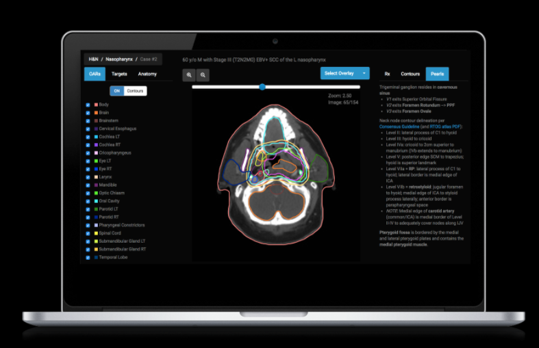 eContourRadOnc's tweet photo. 💡Share https://t.co/0fcpczK7T0 with new PGY-2 #radonc #residents for quick ref 💻 or📱to contouring guidelines, pearls for chart rounds, links to pubs + anatomy 🫁.

🙏 @Sushilberiwal @JeremyPriceMD1 @ARRO_org  @helenyuezha @MV_Sherer for leading case updates! https://t.co/CamqVFmHoy