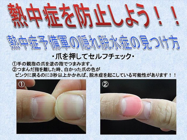 熱中症予備軍に要注意！「隠れ脱水症」のセルフチェック！