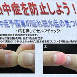 熱中症予備軍に要注意!「隠れ脱水症」のセルフチェック!