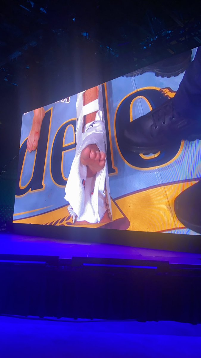 RdosAnjosMMA's tweet photo. Bruised foot https://t.co/jjU6rTp4qc
