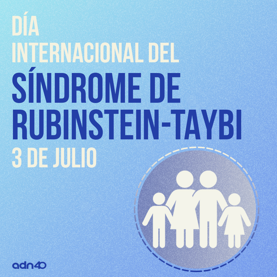 Síndrome de Rubinstein Taiby, una enfermedad rara conmemorada el 3 de julio  - Internacional