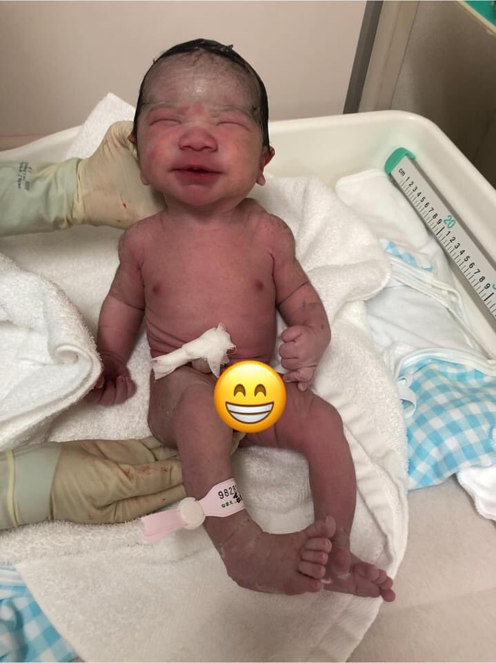 aitocchipapa's tweet photo. 7月3日 23時53分
パッカーンと産まれました😁😁
2575gのちょっと小ぶりな男の子です😍😍
昨日の夕方あたりから前駆陣痛っぽいのがきていたらしく約6時間というスピード出産🤭
コロナの関係で一緒に立ち会いは出来なかったけど
病院連れて行って20分程で誕生☺️
母子共に健康です😁
以上事後報告でした😊 https://t.co/j6gdfcuOeP
